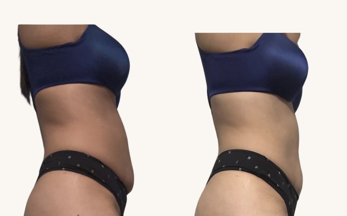 SLEEK PHYSIQUE- Topical skin tightening lotion - Image 3