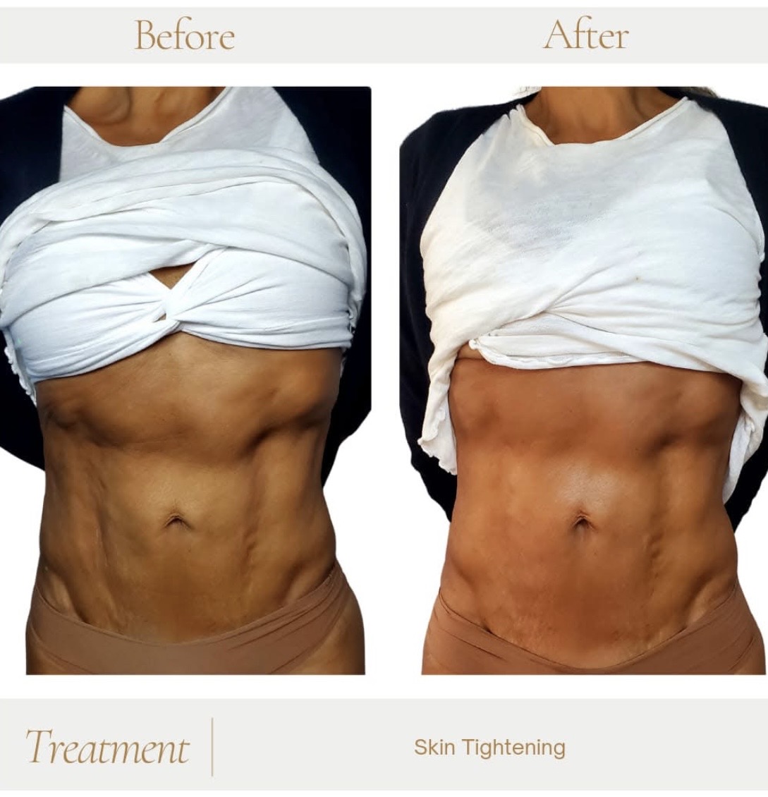 SLEEK PHYSIQUE- Topical skin tightening lotion - Image 4