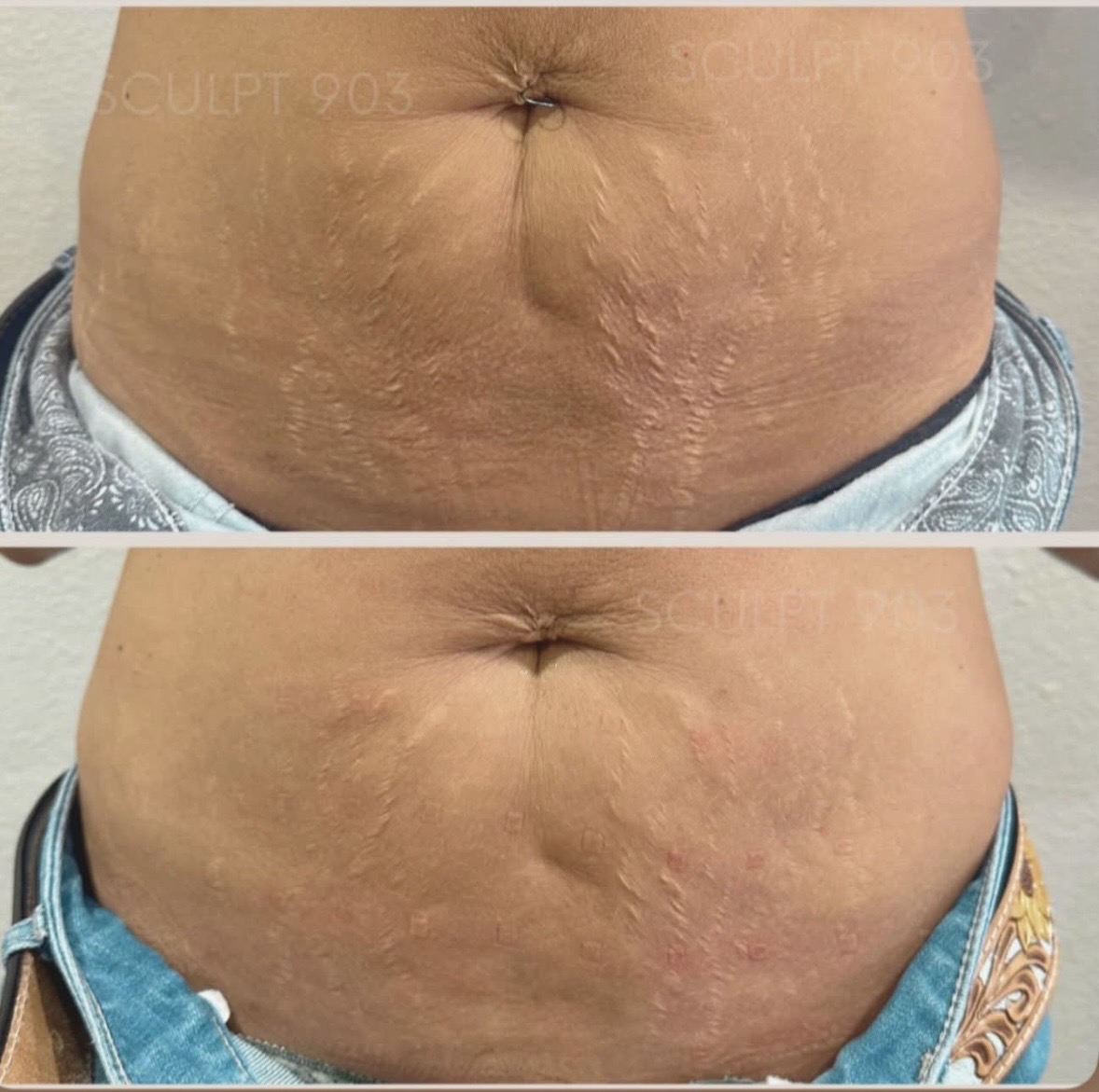 SLEEK PHYSIQUE- Topical skin tightening lotion - Image 5