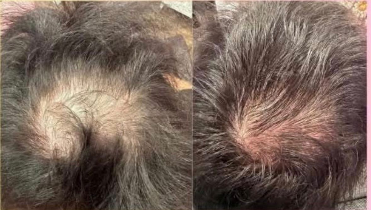 NuGrowth Hair Growth Oil — Root-Restoring Nutrition for Fuller, More Resilient Hair - Image 3
