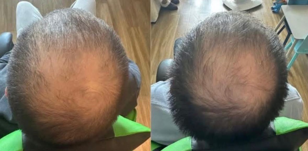 NuGrowth Hair Growth Oil — Root-Restoring Nutrition for Fuller, More Resilient Hair - Image 5